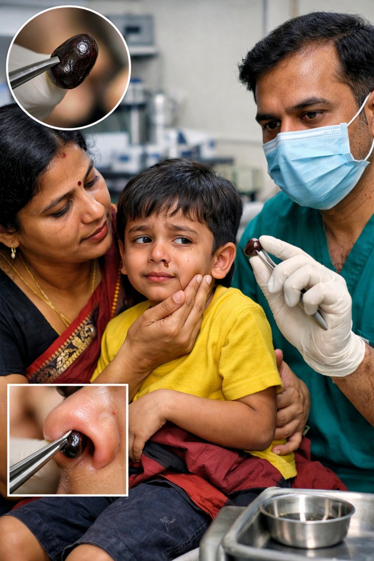 बिना चीर-फाड़ के मासूम की नाक से निकाला गया इमली का बीज, टला बड़ा खतरा